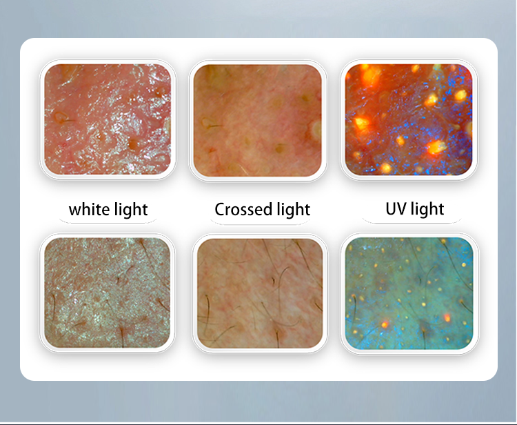 facial test analysis x5 pro machine