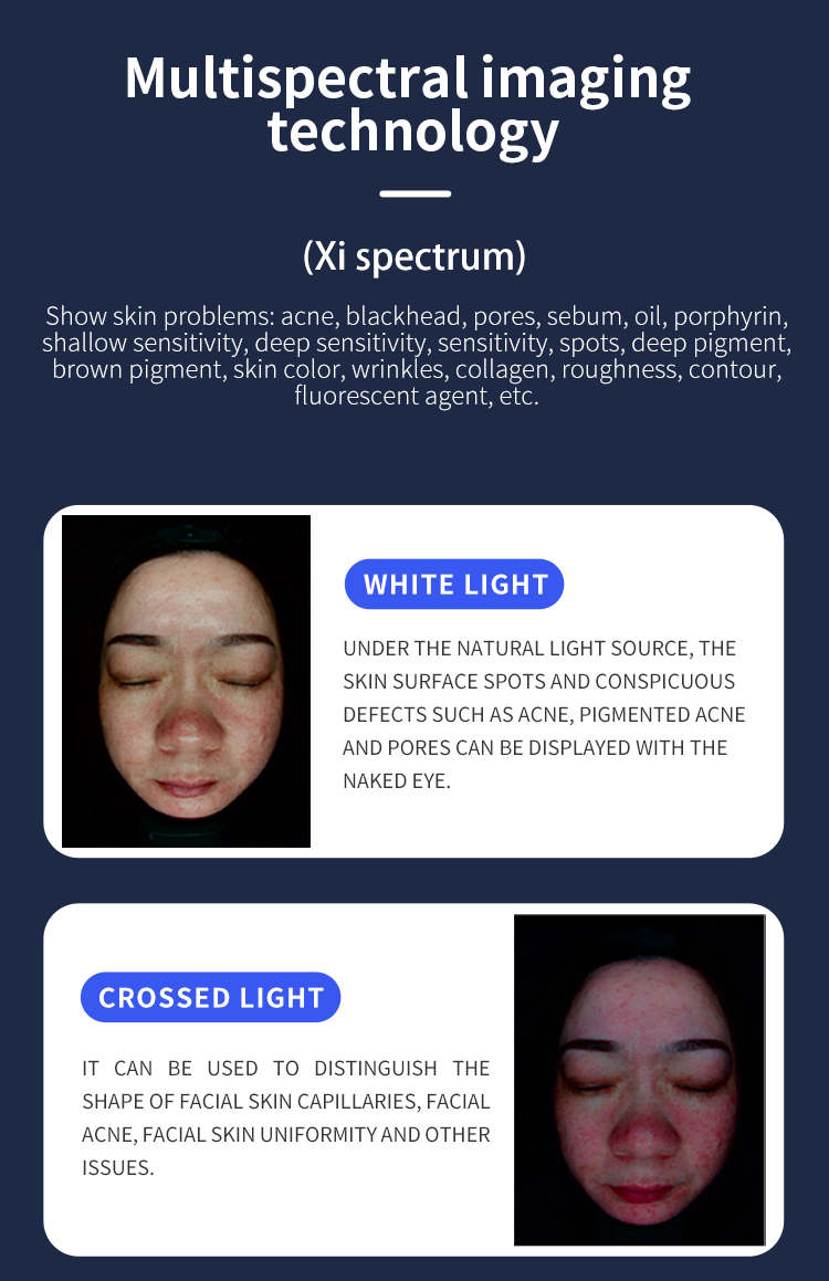 facial test analysis x5 pro machine