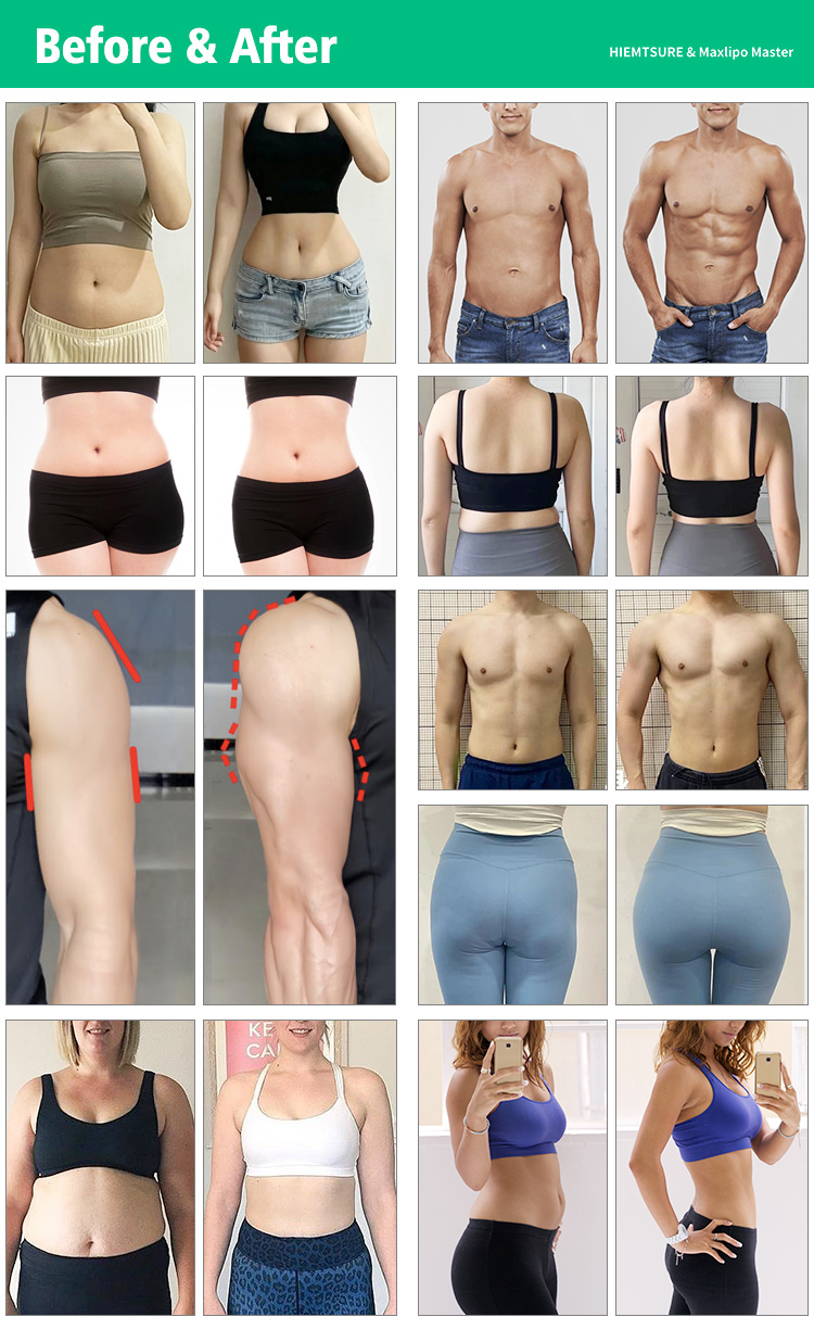 10d laser lipo ems muscle building machine22