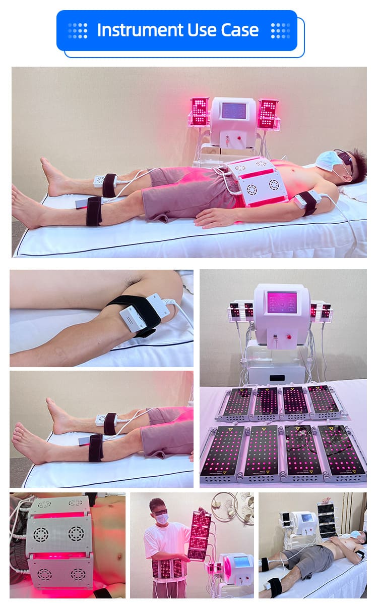 non invasive lipo machine