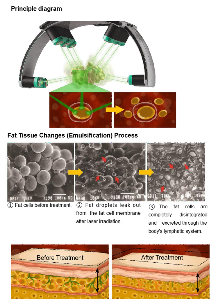 lipo laser weight loss slim machine