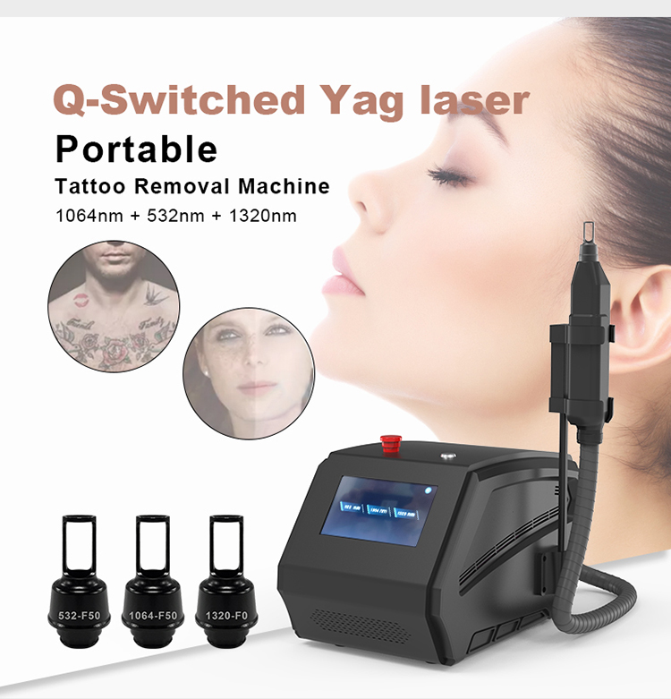 laser tattoo removal machine for sale04