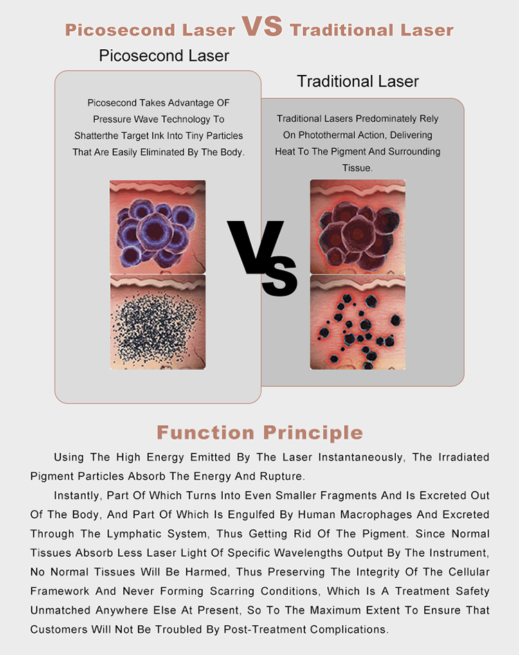 laser tattoo removal machine for sale05