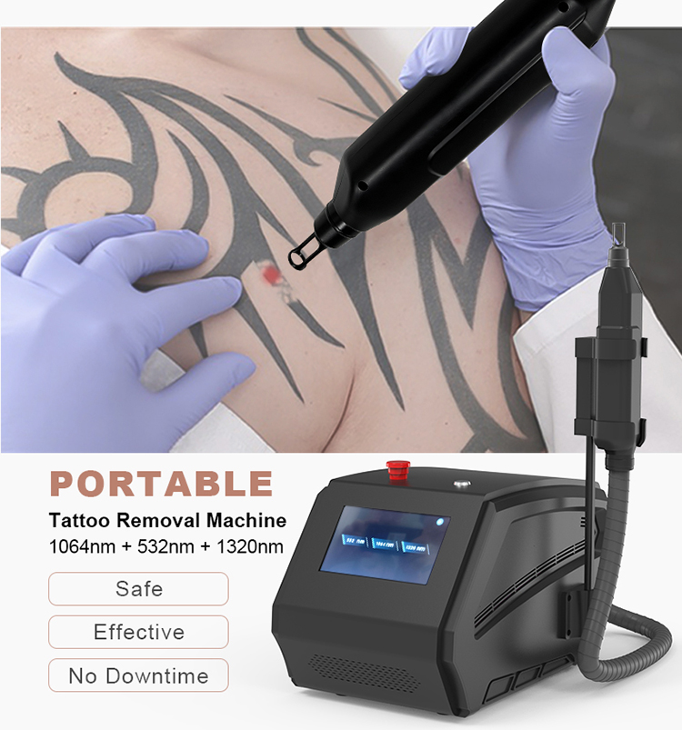 laser tattoo removal machine for sale07