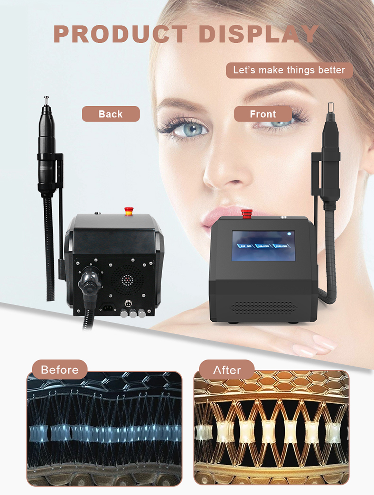 laser tattoo removal machine for sale08