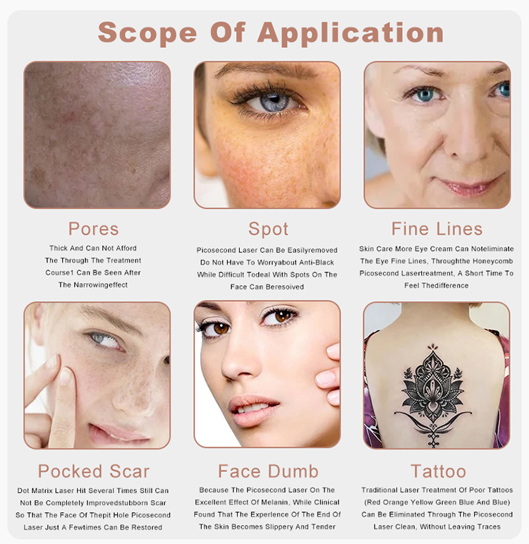 laser tattoo removal machine for sale09