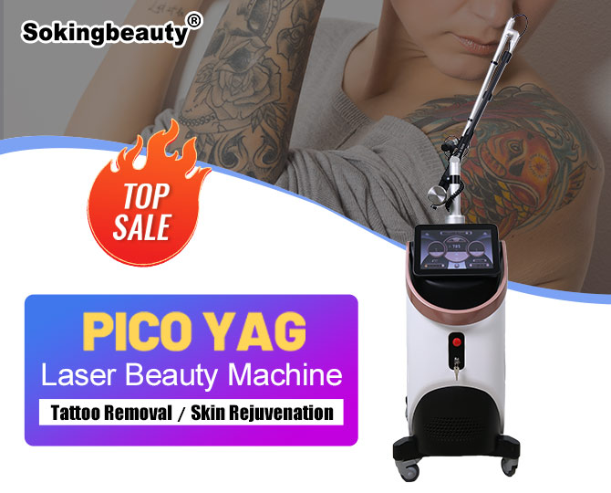 nd yag laser tattoo removal machine