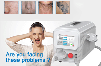 picosure laser tattoo removal machine for sale	