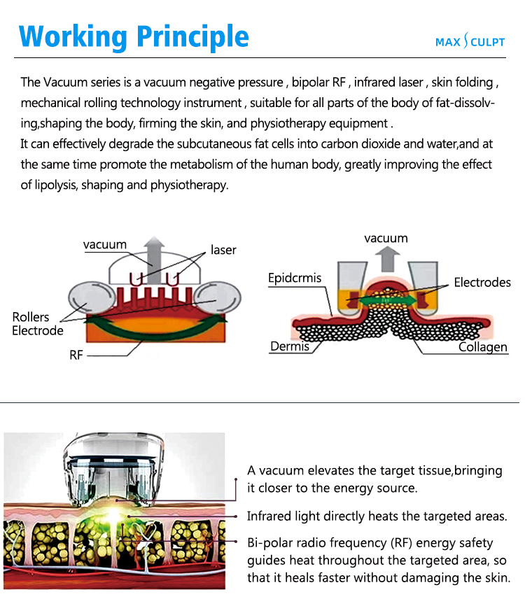 velashape machine02