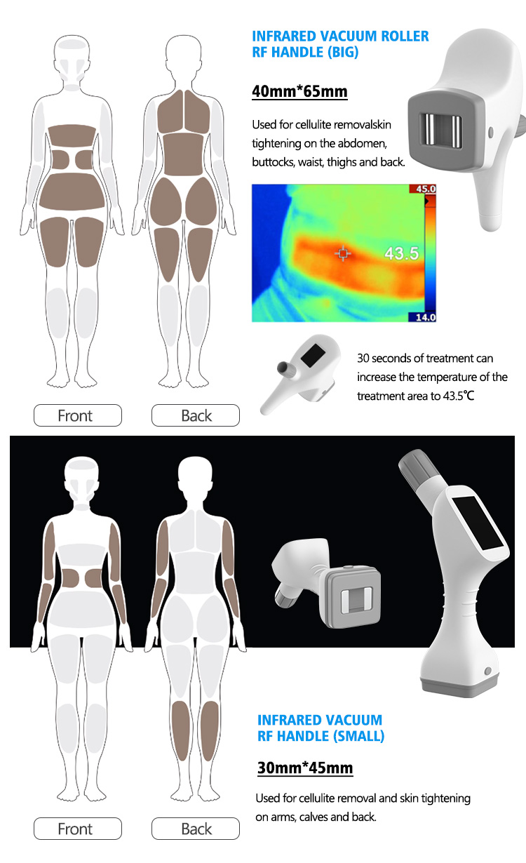 velashape machine13