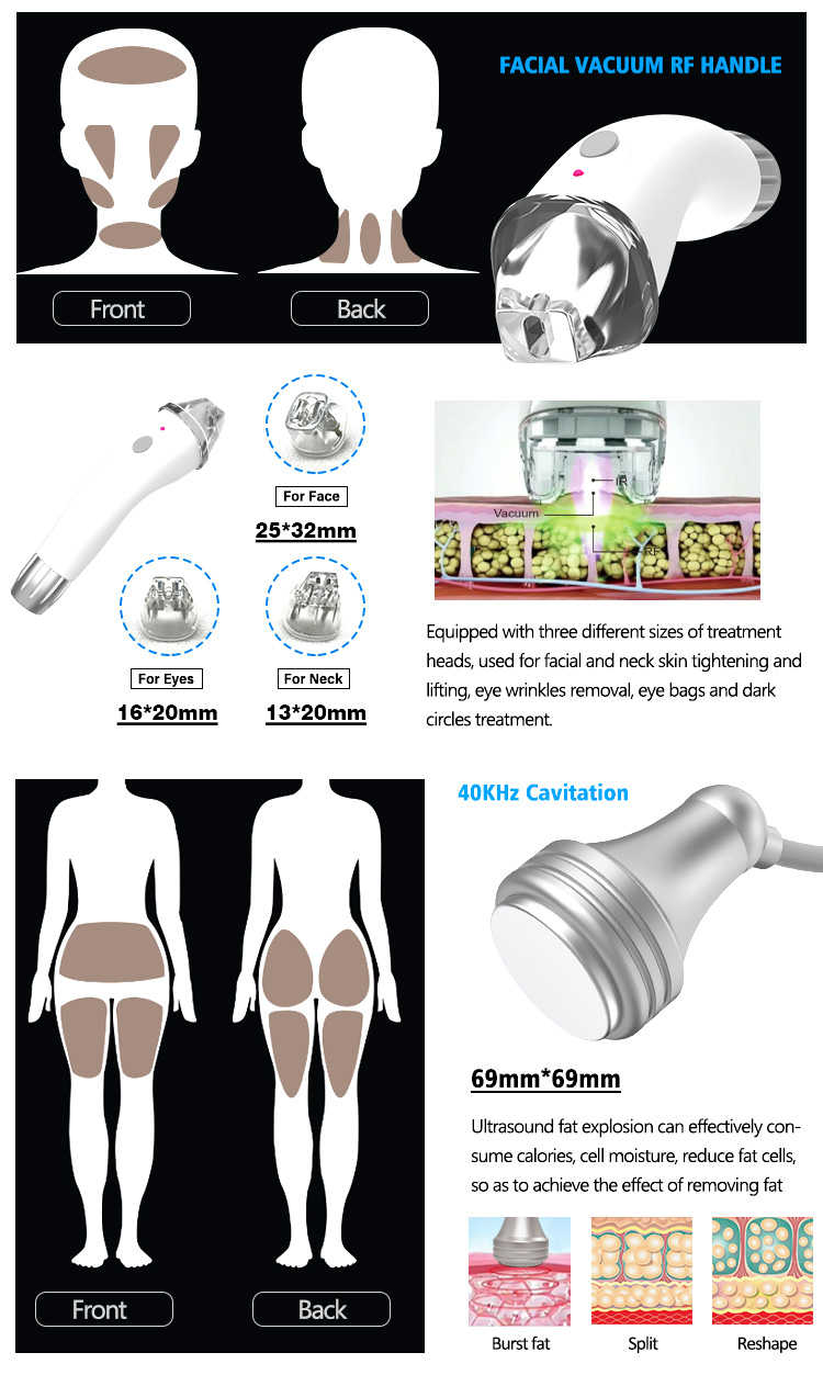 velashape machine14