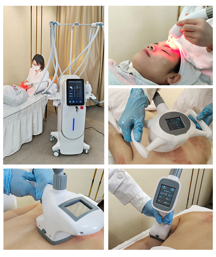 Fat Loss Vacuum RF Machine23