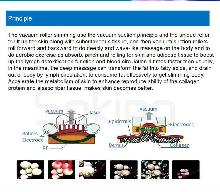 velashape machine price