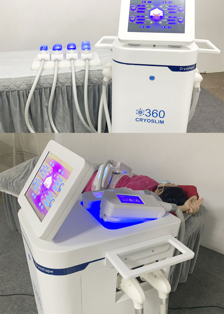 360 cryolipolysis