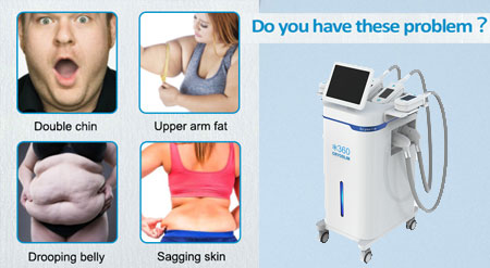 cryolipolysis machine advangates