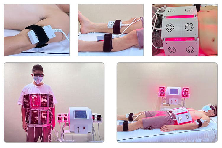 lipo light machine