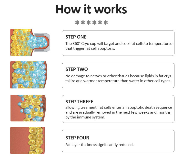 5 handles 360 cryolipolysis machines for fat