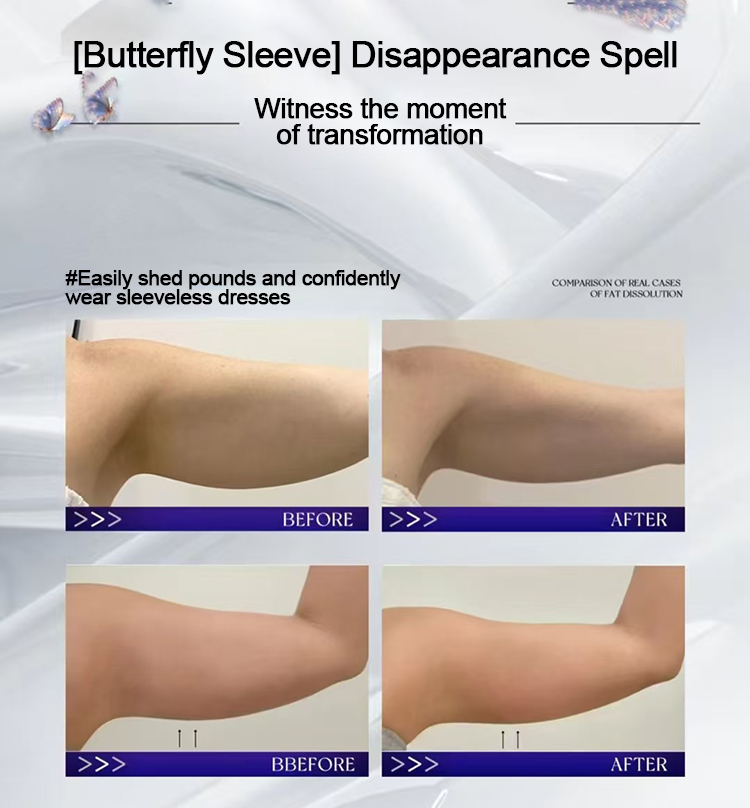 Cool Fat Removal machine09