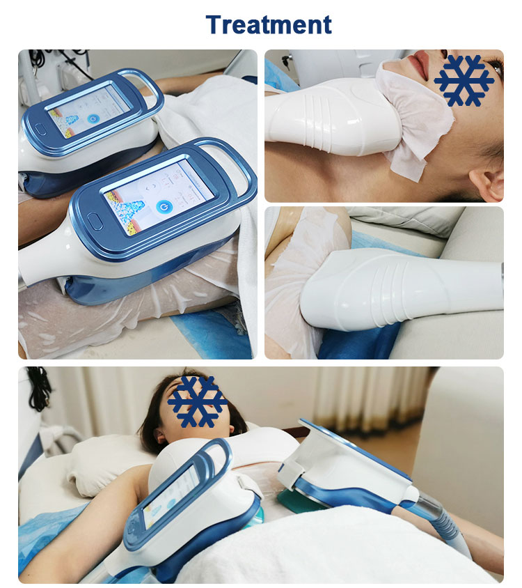 cryolipolysis machine for sale