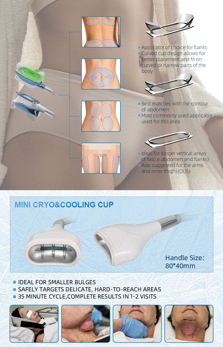 cryolipolysis machine price