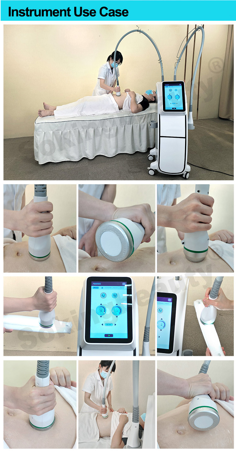 Cryo Fat Reduction Machine17