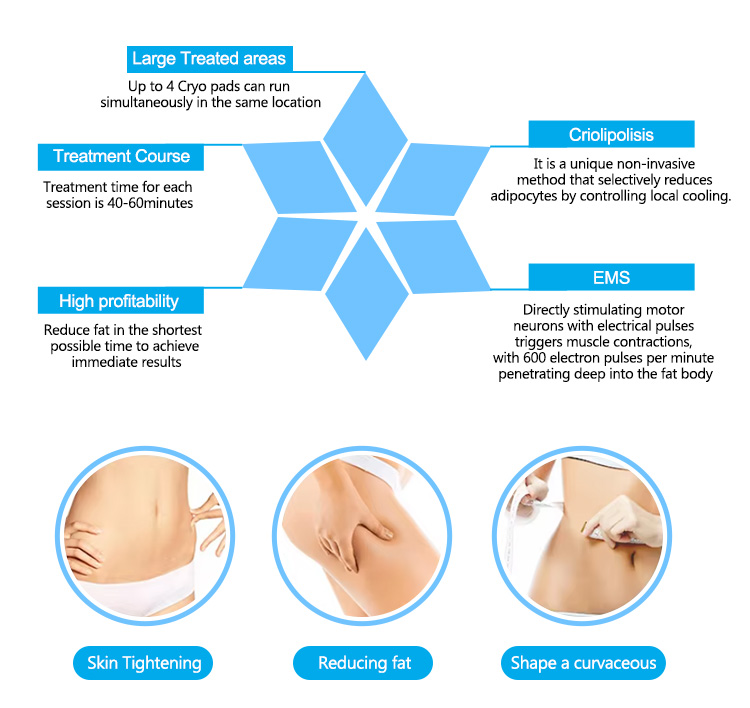 Cryo EMS slimming beauty machine11