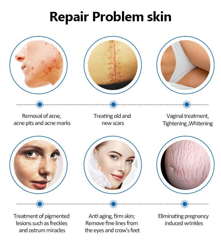 Fractional CO2 Anti Aging Device02