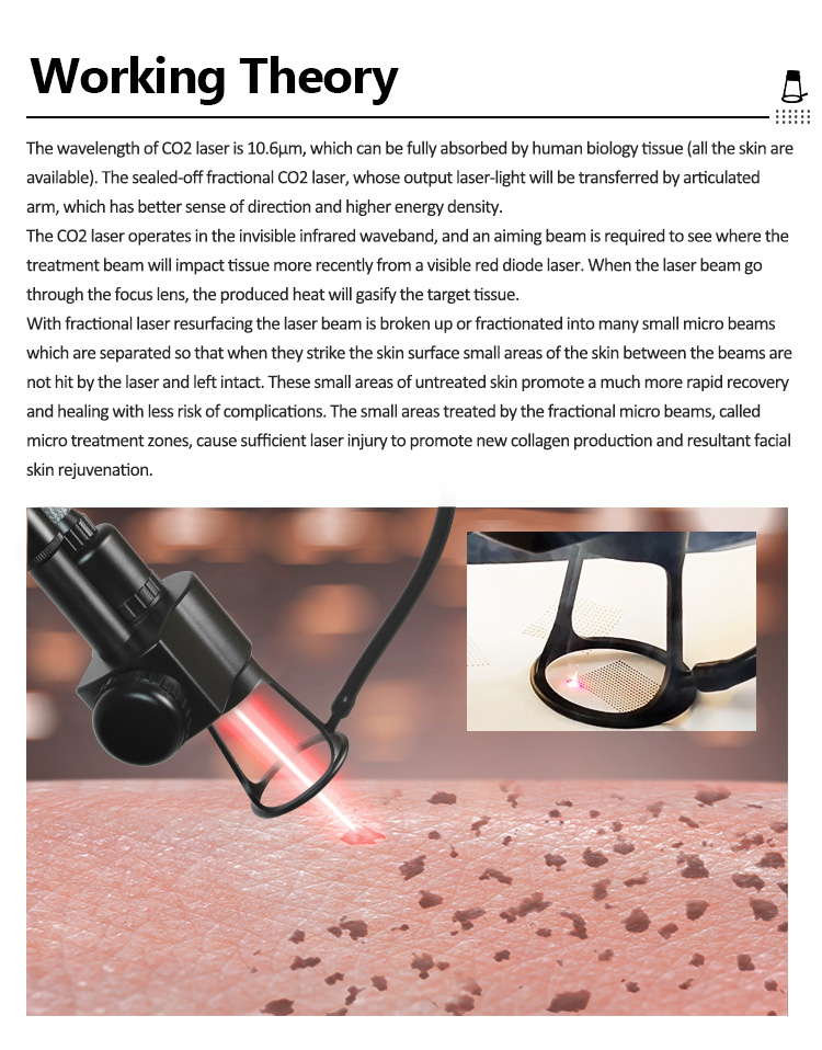 Fractional CO2 Anti Aging Device03