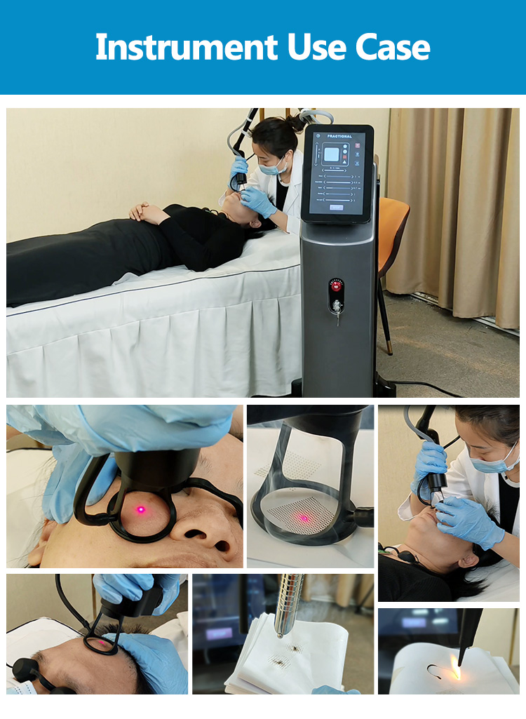 Fractional CO2 Anti Aging Device20