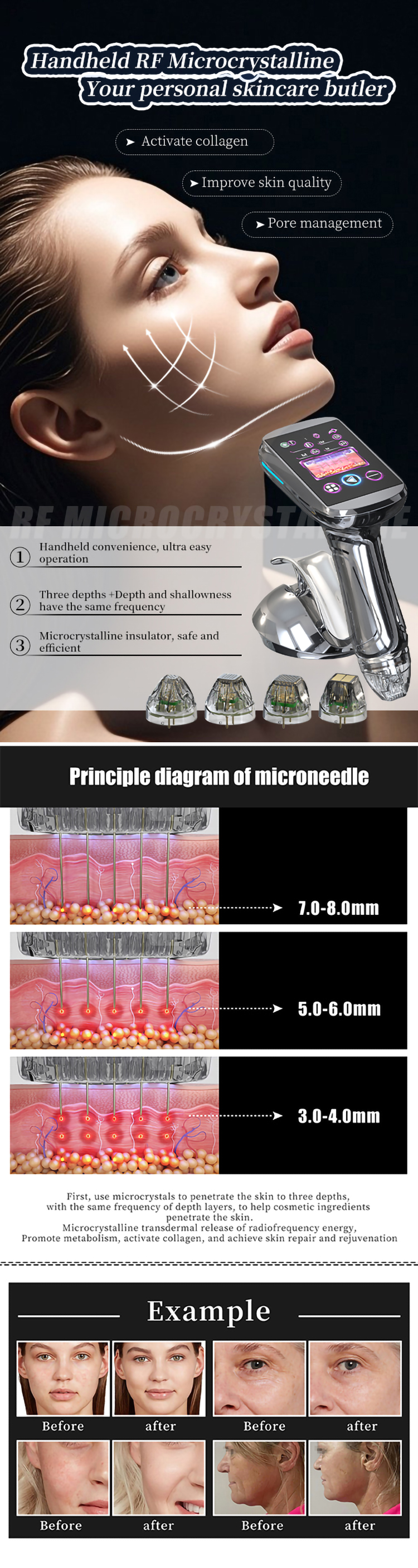 wrinkle removal RF machine04