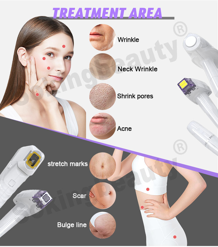 rf microneedling best device