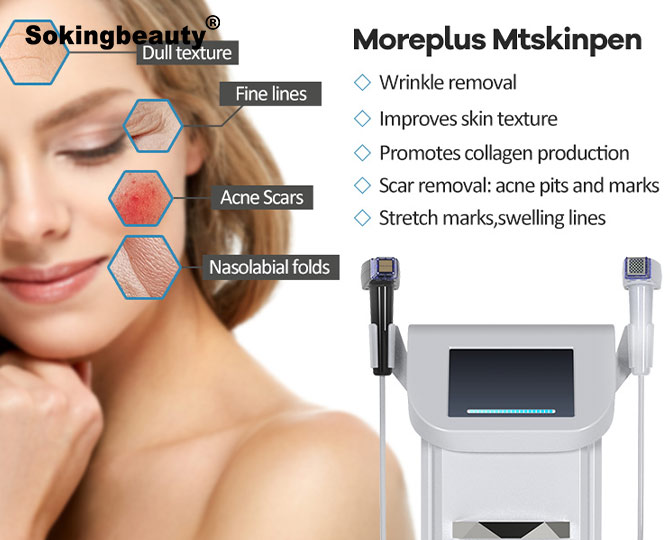 rf fractional microneedling machine