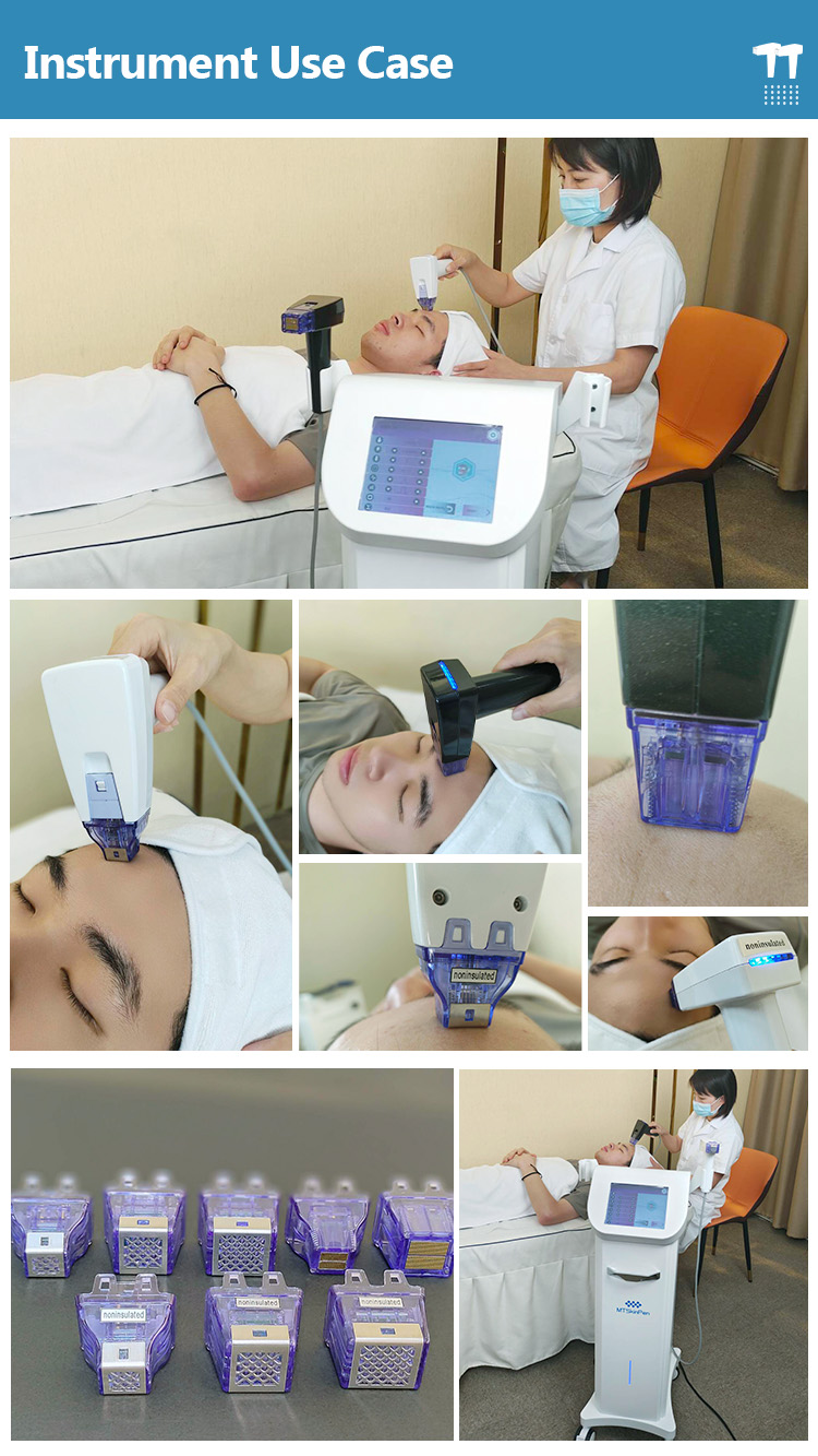 rf microneedling machine fractional19