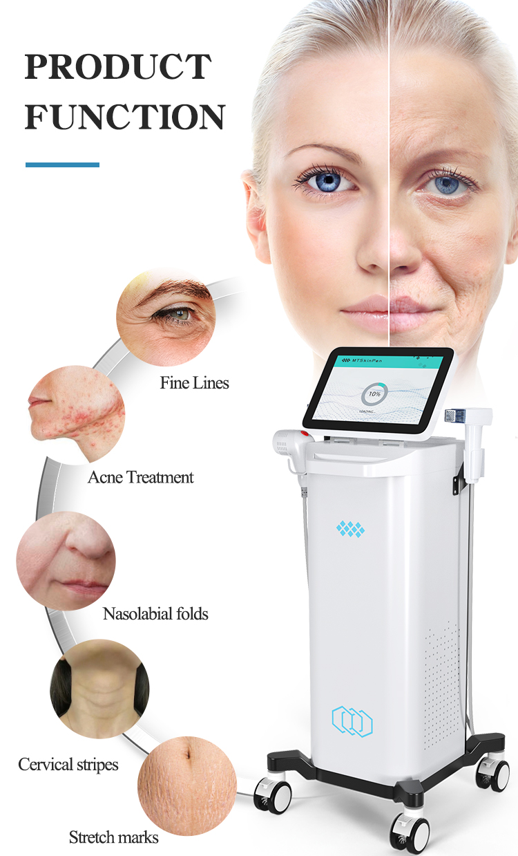 Fractional RF Wrinkle Removal Equipment18