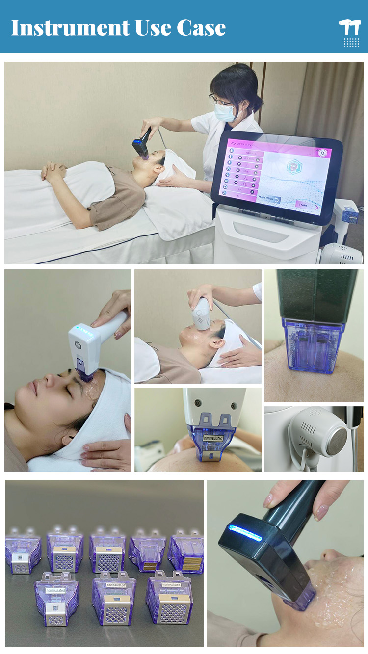 Fractional RF Wrinkle Removal Equipment20