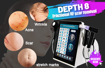 fractional rf microneedling machine