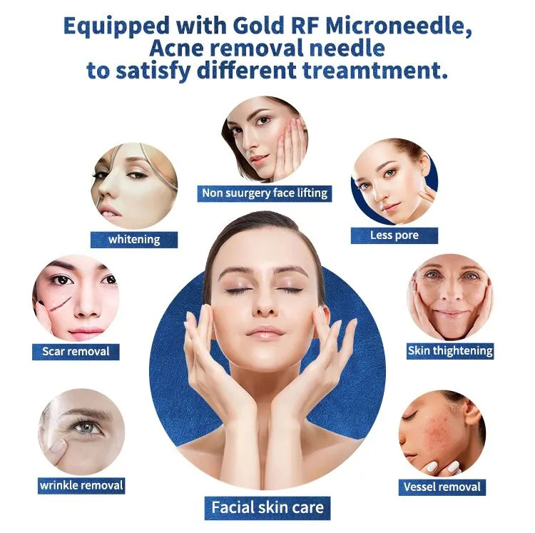 rf microneedle for face