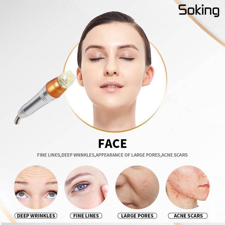 rf microneedling machine for body