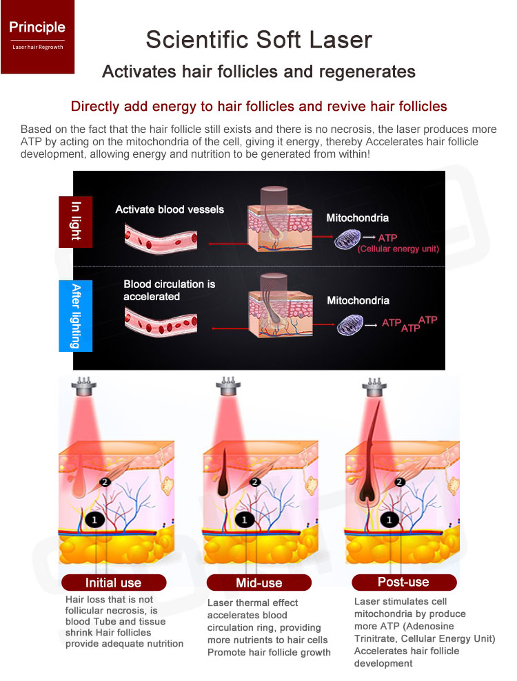 hair growth machine laser