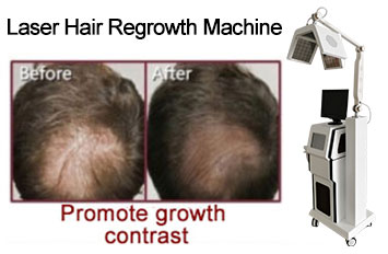 hair growth equipment