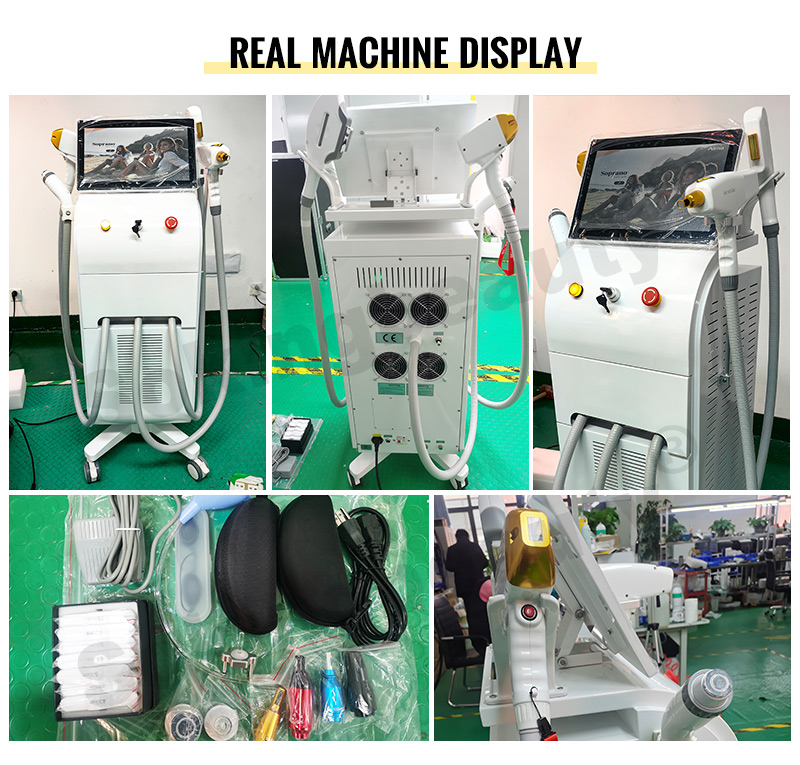 buy laser hair removal machine