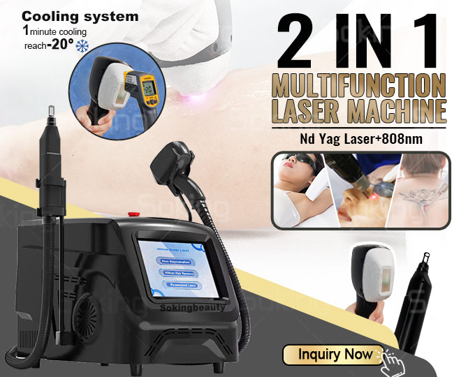 laser hair removal machine