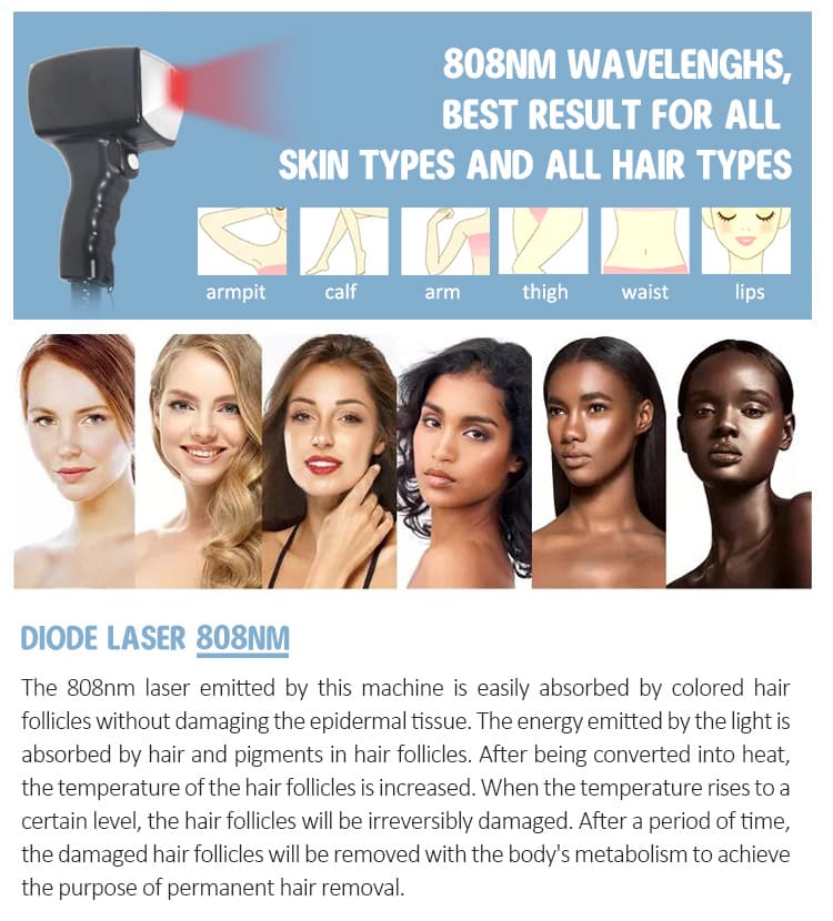 full body laser hair removal cost