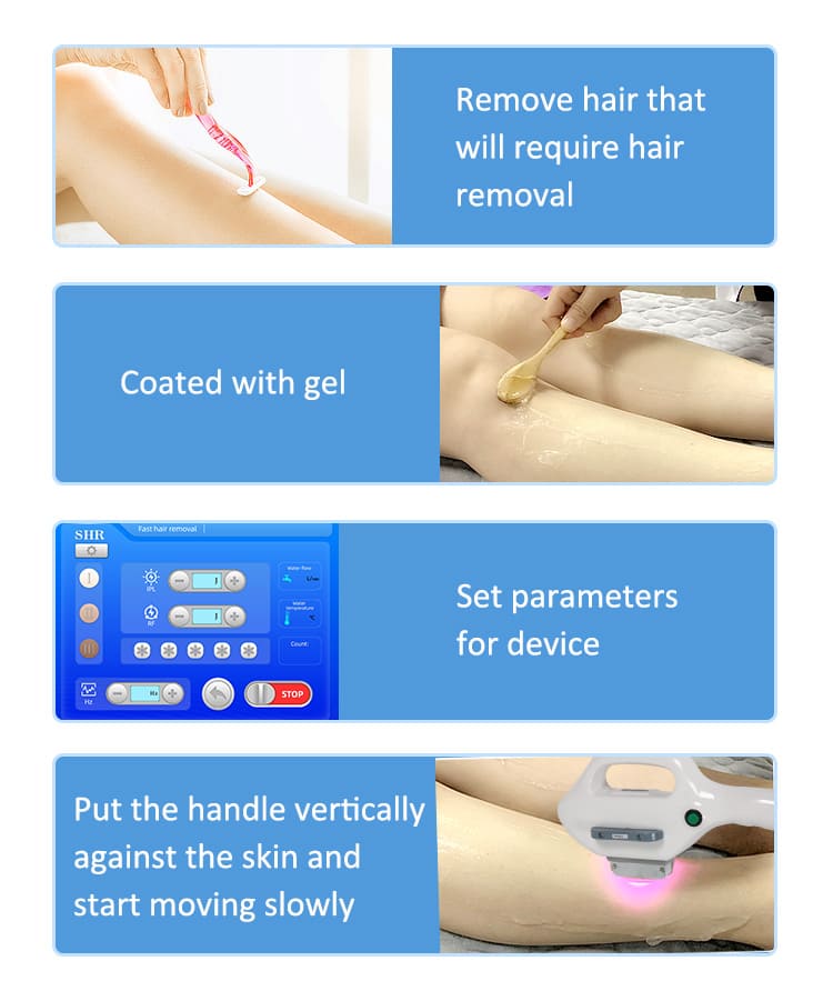 ipl hair removal machine price