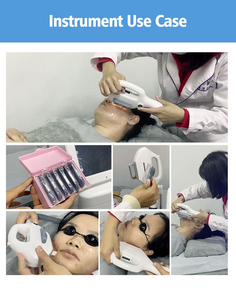 professional ipl hair removal machine