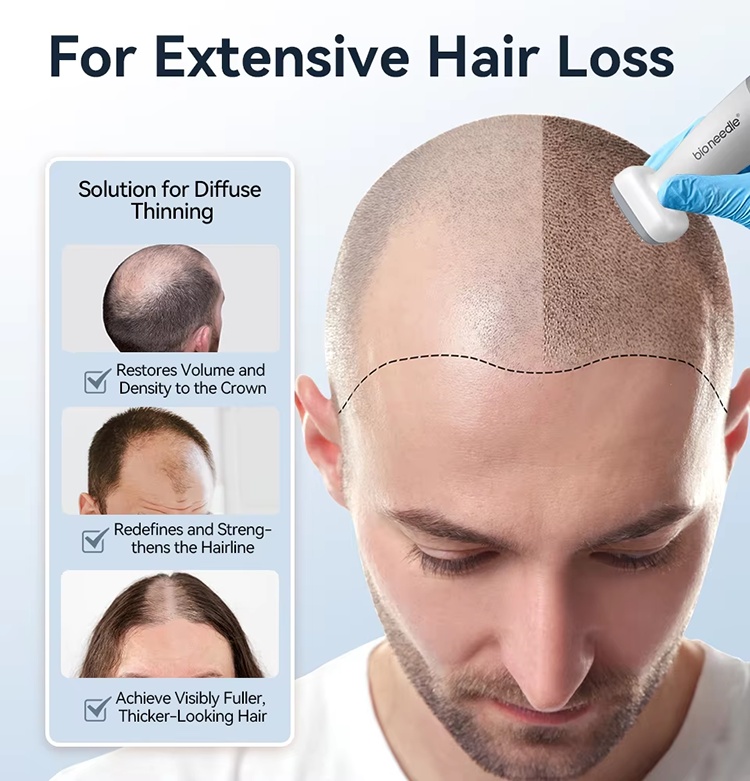 microneedling pen anti aging03