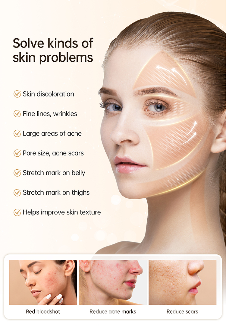 Hydra Pen facial treatment09