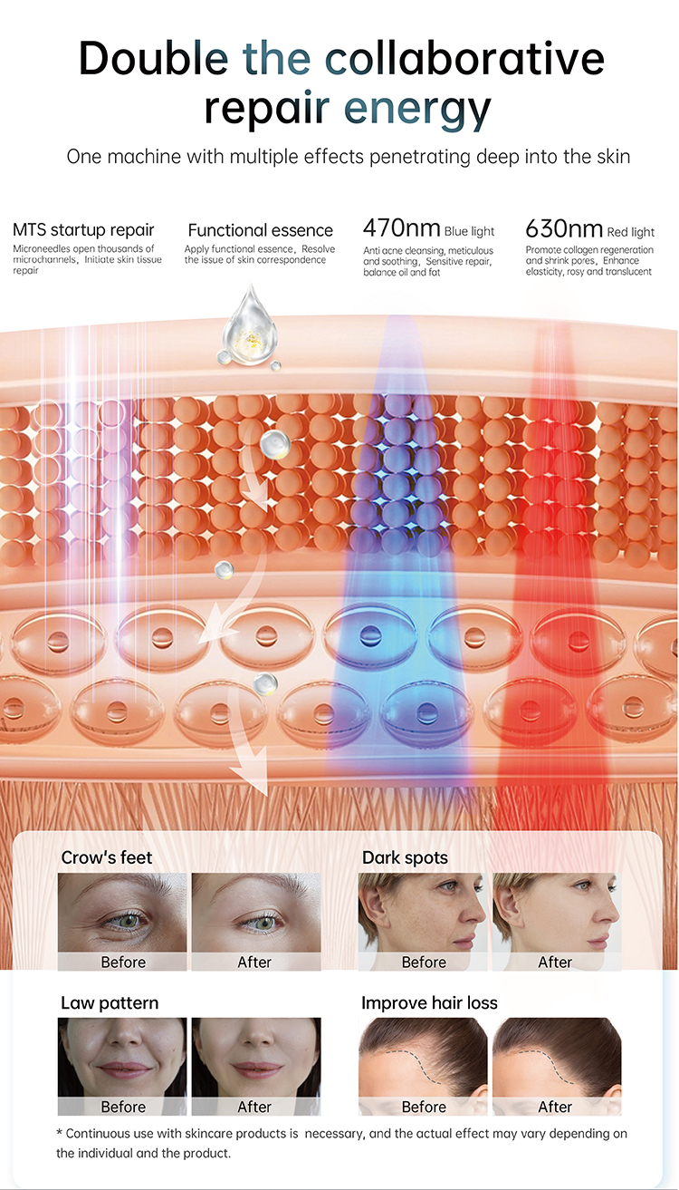 skin rejuvenation microneedle pen09