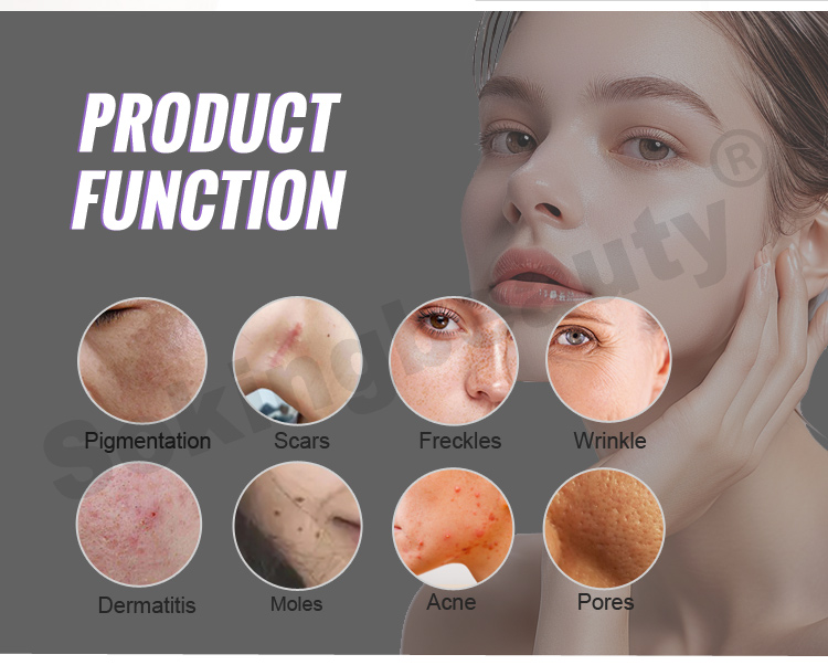 cold plasma acne device