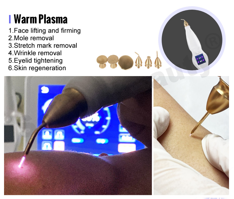 cold plasma acne device